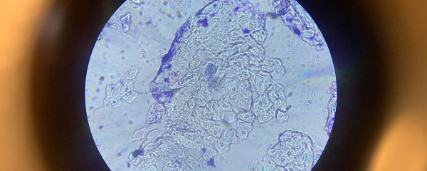 Breng je eigen huidcellen in beeld
